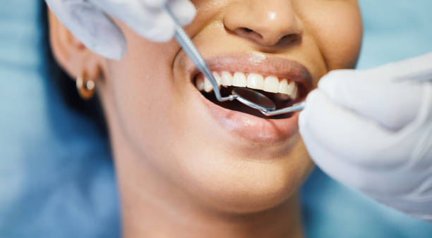 Best Urgent Dental Care in Whitg, IN