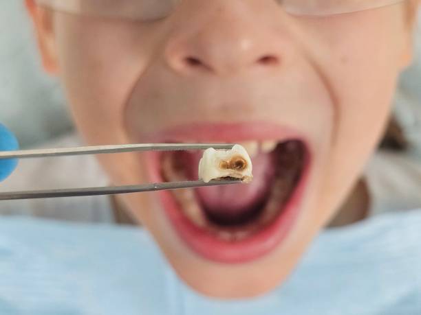 Best Same-Day Emergency Dentist in Whitg, IN
