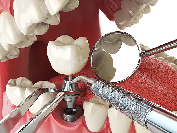 Best Emergency Broken Tooth Repair in Whitg, IN